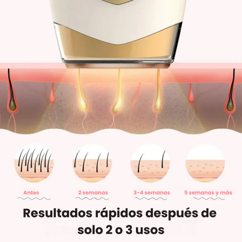 DermoLux – Depiladora Láser IPL Profesional para Uso en Casa