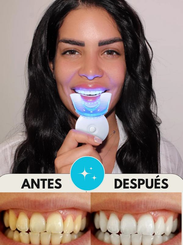 PowerSmile™ - Blanqueamiento profesional en casa